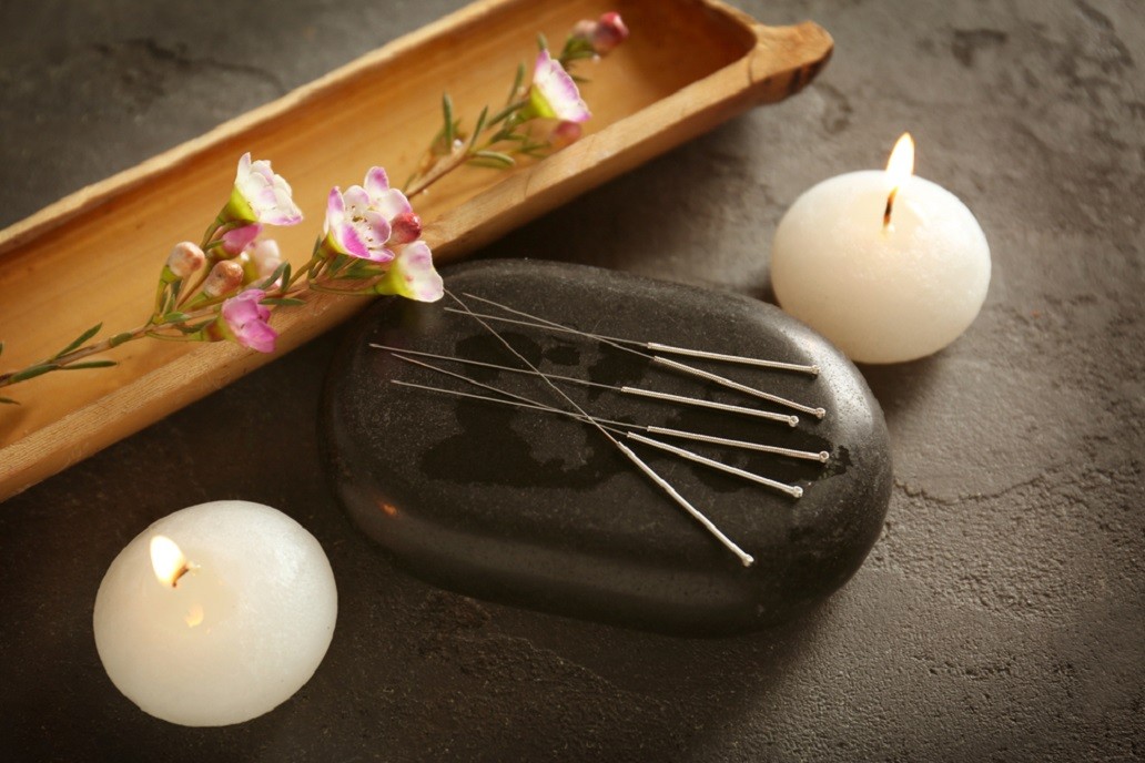 Best Acupuncture Treatment in Calicut